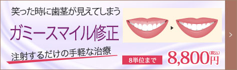 ガミースマイル修正