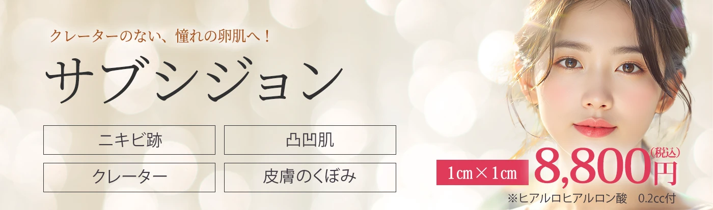 サブシジョン