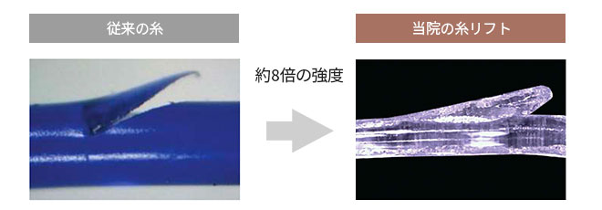 従来の糸 当院の糸リフト