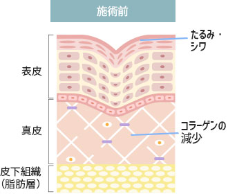 施術前